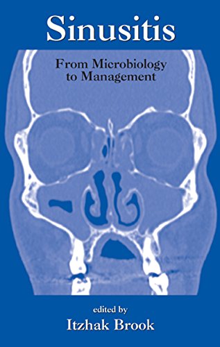 Sinusitis: From Microbiology To Management (Infectious Disease and Therapy Book 35) (English Edition) - Brook, Itzhak