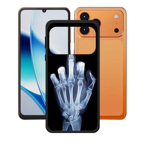 CongJiaLingXi �K�p���� Hotwav A17 Pro Max �p�̃J�o�[ �A�\�t�g�V���R�[��TPU�\�t�g�P�[�X�o���p�[�V�F���v���~�A���ی�P�[�X���J�o�[ �p�� �K�p���� Hotwav A17 Pro Max (6.75") - WZ2