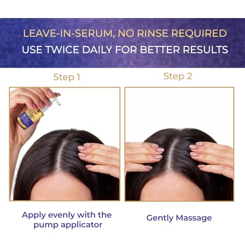 Image of Streax Hair Growth Serum for Scalp, 30 ml with 3% Redensyl, 3% Anagain, 3% Baicapil, Biotin & Caffeine, Hair Serum for Hair Fall Control, For Women & Men