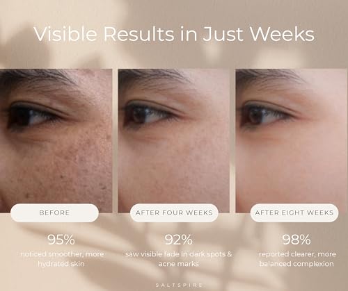 Image of 10% Niacinamide Face Serum with 0.2% Hyaluronic Acid | Dermatologically Tested | Brightening, Hydrating, Acne Marks & Dark Spot Removal | Oil Control, Pore Tightening | For Glowing Skin | All Skin Types | 30ml, CLEAR - ( PACK OF 1 ) (OTHER)