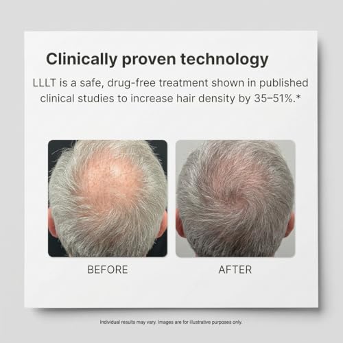 Image of Super Plus Hair Growth Laser Cap (276 Lasers) FDA Cleared Laser Hair Growth Device for Men & Women, SMT Laser Technology, Continuous Output, 6-Min Daily Treatment, Drug-Free Hair Regrowth Cap