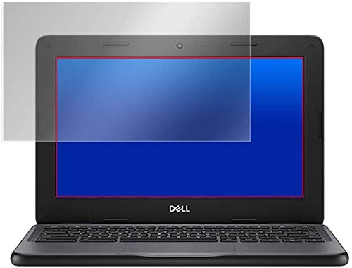 PETtB KX̍dx dx9Hfލ̗p DELL Chromebook 11 3100 Education p { ˖h~tیtB OverLay Plus 9H O9HLDELLCHROMEB3100/2