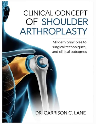 Bild: CLINICAL CONCEPT OF SHOULDER ARTHROPLASTY : Modern Principles to Surgical Techniques, and Clinical Outcomes. (English Edition) f�r 168,49 EUR bei amazon.de