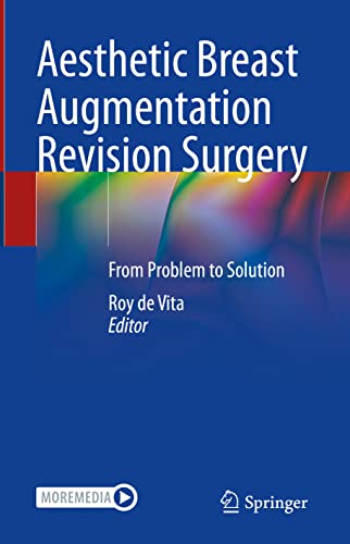 Aesthetic Breast Augmentation Revision Surgery: From Problem to Solution view 2