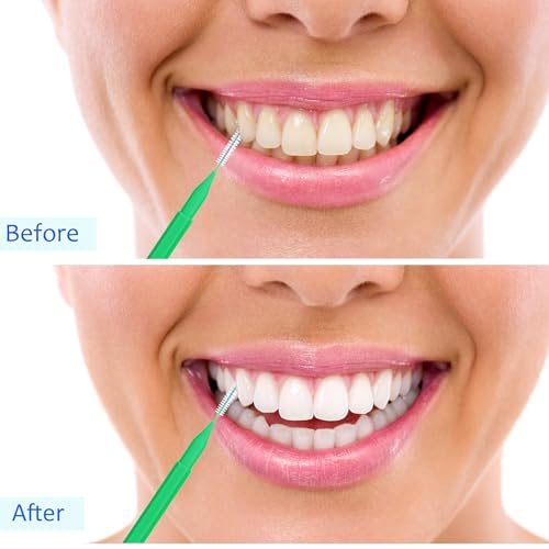 Image of Patelai 100 Pieces Braces Dental Brush for Cleaner Interdental Toothpick Dental Tooth Flossing Head Oral Hygiene Flosser Toothpick Cleaners Tooth Tool(Green,Pink,Mixed Size)