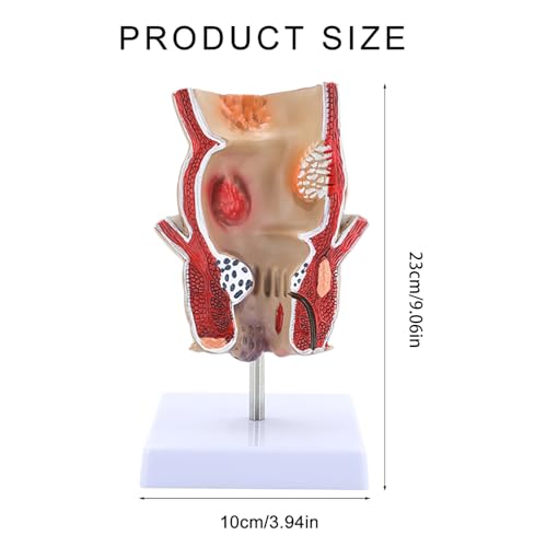 Modèle rectum humain outil pédagogique pour pathologies du rectum - 4