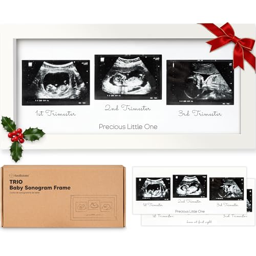 Image of KeaBabies Baby Sonogram Picture Frames - Trio Ultrasound Picture Frames, First Time Mom Gift, Cute Pregnancy Reveal Photo Frame, Baby Gender Reveal Gift, Newborn Nursery Decor (Alpine White)