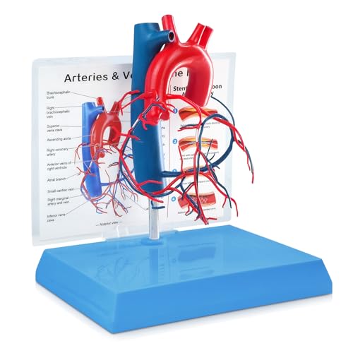 Image of NEW HORIZON Human Heart Model Vascular Heart, Naturally Size, with base Increased sized coronary anatomy depicting the cardiac veins