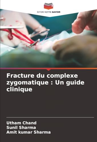 Fracture du complexe zygomatique: Un guide clin... [French] 6203896705 Book Cover