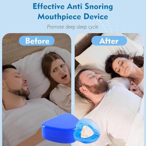 Miniatura 4 de Yunfan Anti Snoring Mouthpiece - Universal Size,Anti Snoring Devices For Sleep,Food Grade Material Snore Mouth Guard,Instantly Quiet Antisnoring Device Mouthpiece,Make The Night Quiet 2