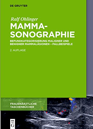 Mammasonographie Befundkategorisierung Maligner Und Benigner Mammalasionen Fallbeispiele Frauenarztliche Taschenbucher Ebook Ohlinger Ralf Amazon De Kindle Shop