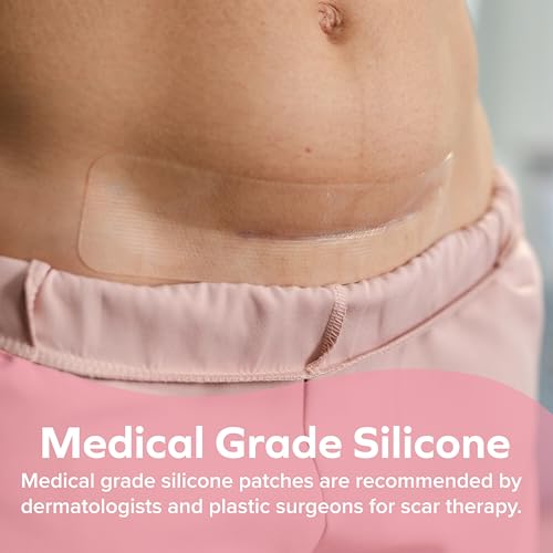Image of Dr. Talbot's Mom Stretch Mark & C-Section Scar Strips - Medical Grade Silicone Scar Strips to Soften and Flatten Surgical Scars - 6 Count (60-Day Supply)