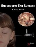 Endoscopic Ear Surgery