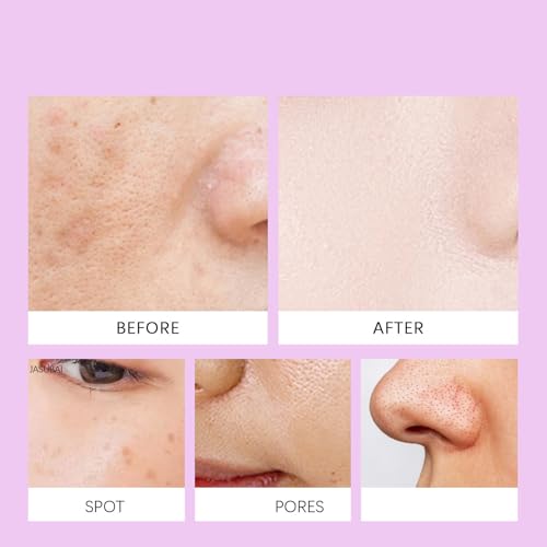 Sérum correcteur de taches brunes et ridules, coffret hydratant visage de 6 pièces