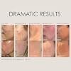 REFLEKT 2 Vitamin C Brightening Anti-Aging Serum Collagen-Boosting with Peptides & Hyaluronic Acid, Radiance & Elasticity Enhancer, Clean, Vegan, Cruelty-Free, Fragrance & Paraben-Free Formula
