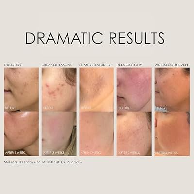 REFLEKT 2 Vitamin C Brightening Anti-Aging Serum Collagen-Boosting with Peptides & Hyaluronic Acid, Radiance & Elasticity Enhancer, Clean, Vegan, Cruelty-Free, Fragrance & Paraben-Free Formula