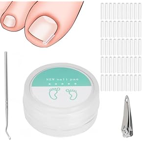 巻き爪ケア - Amazon.co.jp