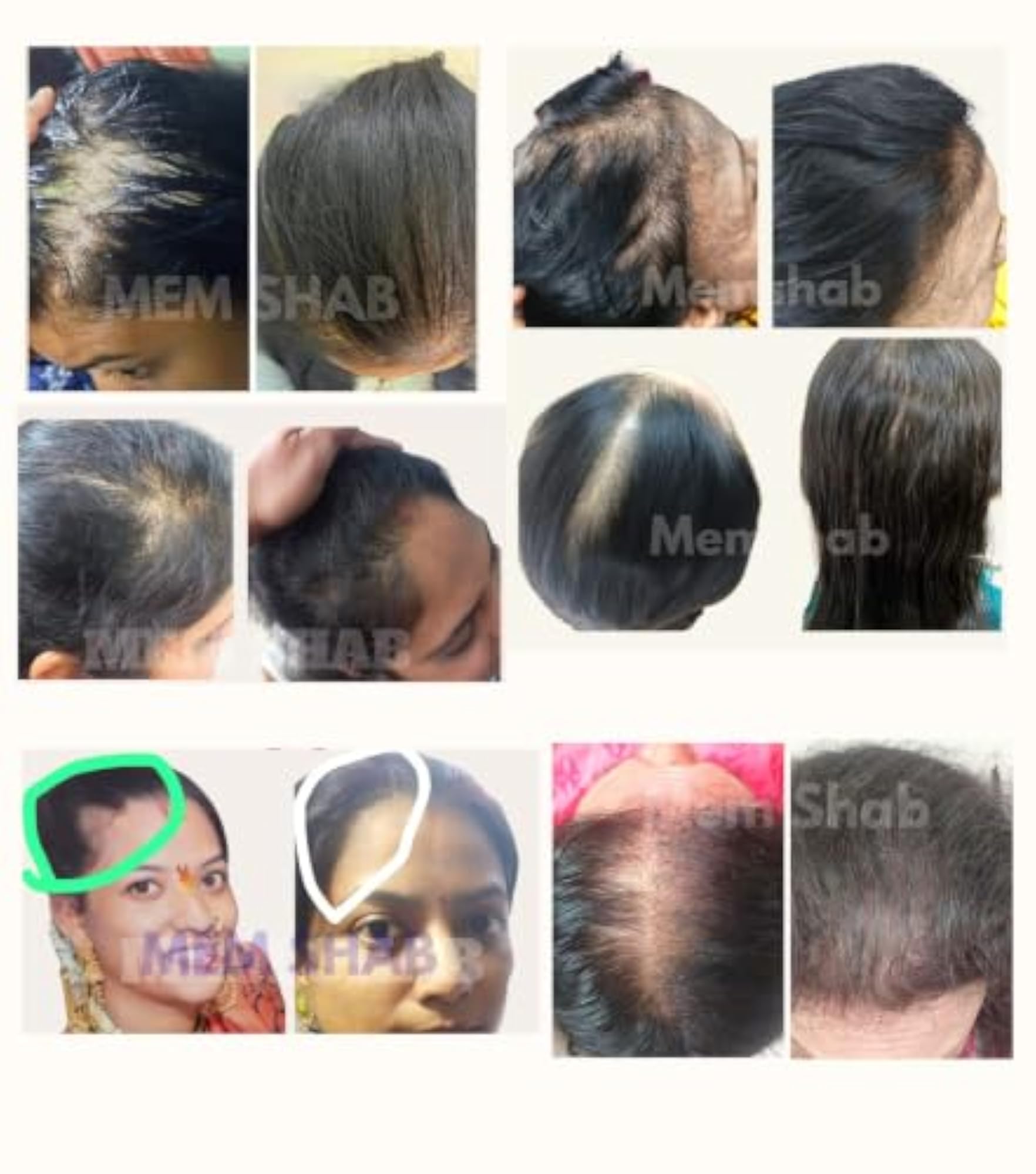 Hair Care Combo for Fall Control & Healthy Growth