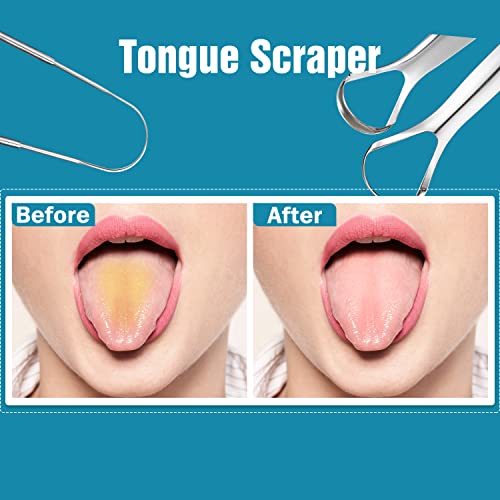 3 PCS Metal Tongue Scraper, Tongue Scrapers for Adults, Stainless Steel Tounge Scrappers, Tounge Scraper, Portable Tongue Scrappers YLYL - Thumbnail 4