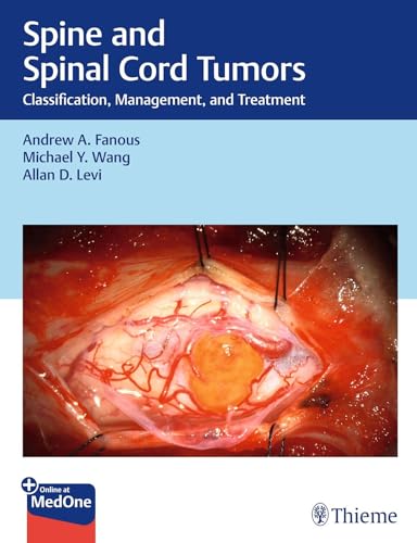 Spine and Spinal Cord Tumors: Classification, Management, and Treatment