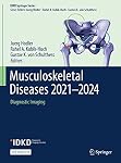 Musculoskeletal Diseases
