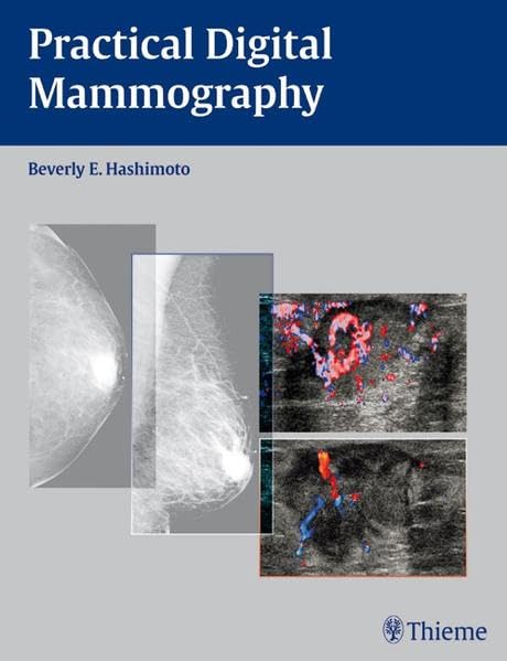 Buy Practical Digital Mammography — BookShops.in