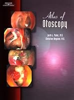 Atlas of Otoscopy 0769300111 Book Cover