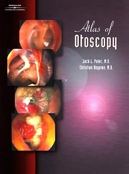Hardcover Atlas of Otoscopy Book
