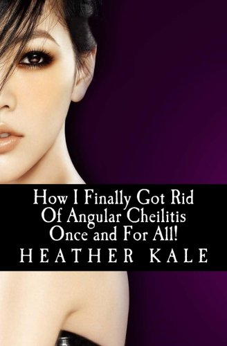 How I Finally Got Rid Of Angular Cheilitis Once an: Cracked Mouth Corners No More