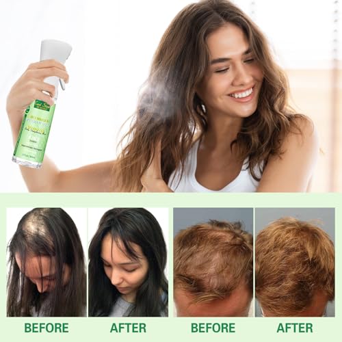 Spray de Agua de Arroz y Romero para Cabello 10 fl oz miniatura 6
