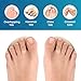 Kimihome Toe Straighteners – 2-Pair Toe Aligners Gently Realign Crooked, Overlapping & Hammer Toes, Flexible Design for All-Day Comfort & Discreet Wear