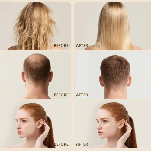 Image of 100% Natural Raw Batana Oil for Hair Growth, Unrefined & Organic Dr Sebi Hair Growth Oil From Honduras, Prevents Hair Loss, Eliminates Split Ends, Enhances Thickness 4.23 Fl Oz