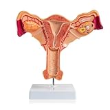  Modell Der Menschlichen Gebärmutter Und Des Eierstocks,Anatomisches Weibliches Genitalmodell, Fortpflanzungsorgane,Zeigt Gebärmutter,Eierstock,Vagina,Für Die Medizinische Lehre Der Gebärmutter