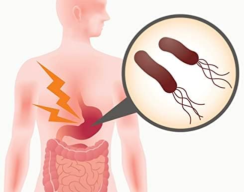 PCI H. Pylori Analysis - Non-Invasive Stool Test for Bacterial Infection Detection, Convenient & More Accurate Than Regular Home Tests - Testing Package Included for Reliable Diagnosis and Treatment