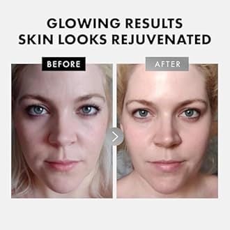 Eclat Skincare Face Serum Set – Vitamin C, Retinol, Hyaluronic Acid for Hydration & Anti-Aging – Brightening & Firming Facial Serums – 3 Pack Face Care Set