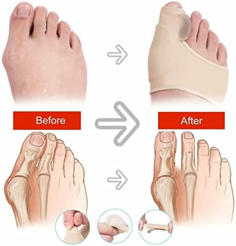 RENOS Orthopedic Bunion Splint - Bunion Corrector (2PCS) - Sleeve for Hallux Valgus Bunion Pain Relief - Non-Surgical Hallux Valgus Correction - Hammer Toe Straightener - Day Night Support