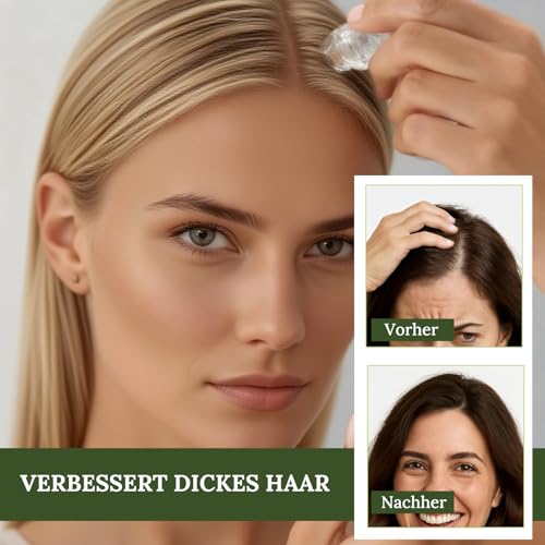 Alphainfuse Hair Nachwachsen System, Hair Regrowth System, Mikrone Haarwachstumserum für Haare Verlustverdünnung, Verstärkt dicke Haare für Männer Frauen, Behandlung für dicker, stärkt die Wurzeln