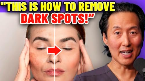 Why Your Dark Spots Won't Go Away (And How to Finally Fix Them)