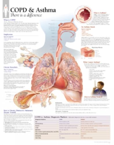 COPD/Asthma chart: Laminated Wall Chart