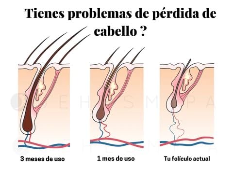 Quick Long Hair (Crecimiento Acelerado)