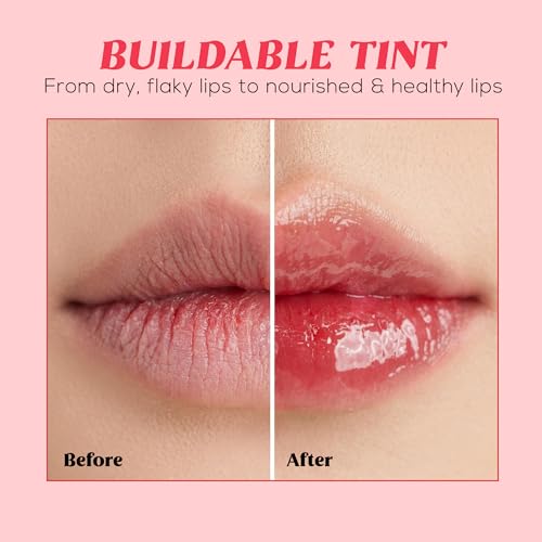 Image of RENEE Juicy Fix Tinted Lip Balm- Sugar Drizzle | Shiny, Glossy Finish | Protects Lips With SPF 30 | Repairs & Nourishes Dry, Flaky Lips | With Peptides, Ceramides & Hyaluronic Acid | 10 g