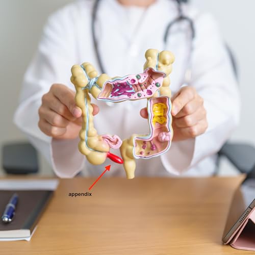 Do You Have "Extra" Parts?