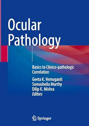 Ocular Pathology: Basics to Clinico-pathologic Correlation-Wow! eBook