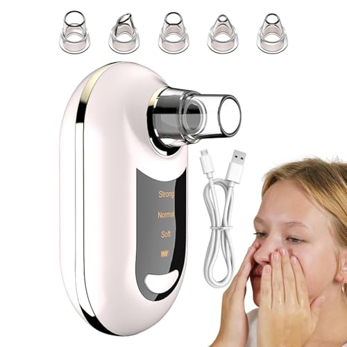 Herramienta removedora de aspiradora, removedor de cabeza negra recargable, removedor de puntos blancos, 3 ajustes de succión, carga USB, extractor de vacío de puntos blancos para el hogar, hombres