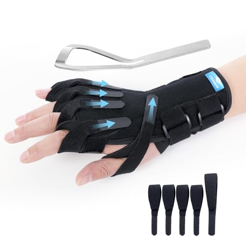 Chonario Radial Nerve Palsy Splint Wrist Drop Brace for Limp Finger Wrist Extension Finger Limp Crutch Palsy Saturday Night and MCP Arthroplasty Stroke Hand Recovery Fits Right & Left Hand