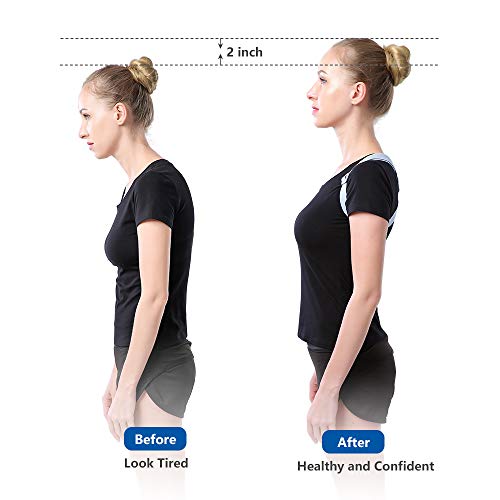 Chiliki Posture Corrector And Trainer With Intelligent Sensor Vibration Reminder To Keep A Health Body Posture - Adjustable Upper Back Brace For Men, Women And Kids(Universal) #TOP1