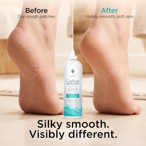 Image of Lee Beauty 6oz Professional Gel Callus Remover for Feet | Easy Self Application, Fast-Acting Formula, Gentle, Cracked Heels & Dead Skin