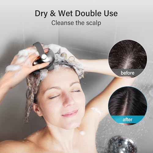 Image of arboleaf Scalp Massager Rechargeable Head Massager Scalp Stress Relax