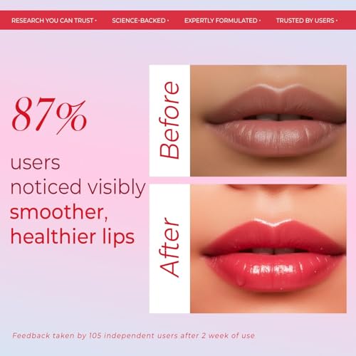 Image of VINR Lip Balm | Lip Balm for Dark Lips | Moisturizing Lip Treatment with Vitamin C + Shea Butter for Soft Lips | INFUSED WITH VITIS VINIFERA | Overnight Repair | 15 gm Pack of 4