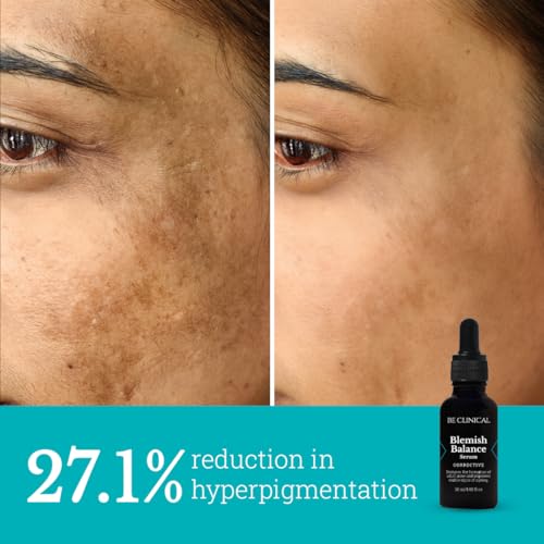 Image of Be Clinical Blemish Balance Serum | For Acne-Prone Skin, Reduces Hyperpigmentation, Fades Acne Marks and Sunspots | Oil Control | Glycolic Acid, Salicylic Acid, LHA